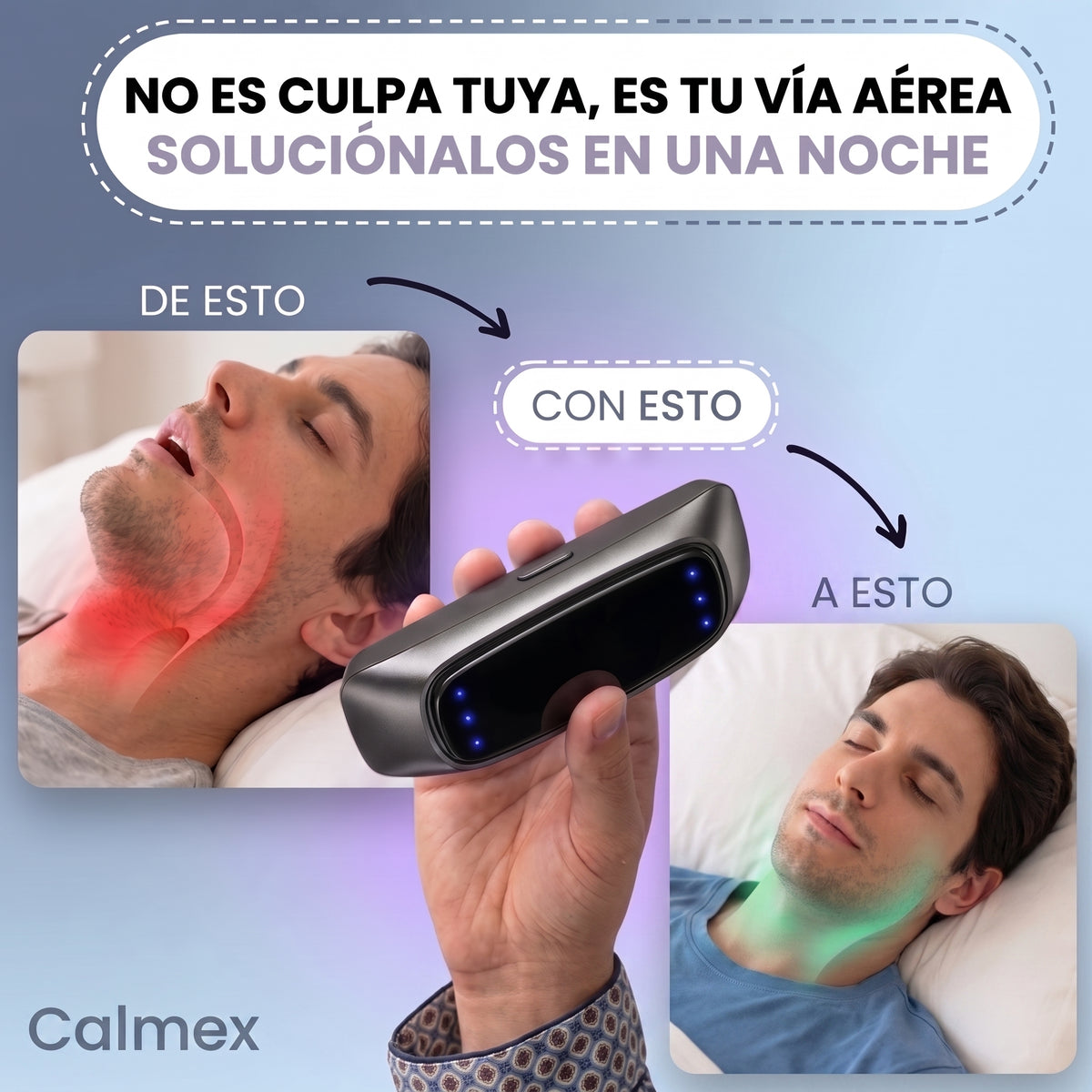 Calmex · Smart Anti-Snoring Device